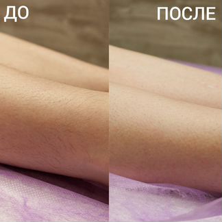 Депиляция (шугаринг/воск) / Ламинирование бровей